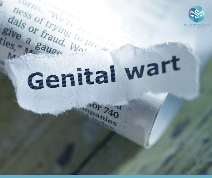 Anogenital Warts