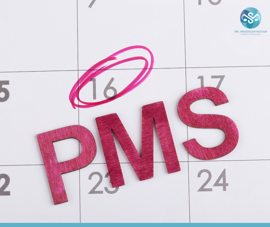 Tracking PMS on Calendar - Premenstrual Syndrome